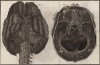 Анатомия. Внутреннее строение мозга и мозжечка по Галлеру. (Ивердонская энциклопедия. Том I. Швейцария, 1775 год)