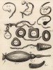 Хирургия. Бандаж для поддержания грыжи, расширитель (Ивердонская энциклопедия. Том III. Швейцария, 1776 год)