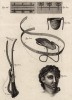 Хирургия. Наложение швов, бандаж для языка (Ивердонская энциклопедия. Том III. Швейцария, 1776 год)