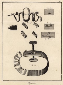 Хирургия. Виды швов, зажим для артерий (Ивердонская энциклопедия. Том III. Швейцария, 1776 год)