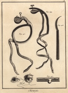 Хирургия. Инструменты для проведения операций на глазах (Ивердонская энциклопедия. Том III. Швейцария, 1776 год)