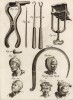 Хирургия. Виды перевязок на голове (Ивердонская энциклопедия. Том III. Швейцария, 1776 год)