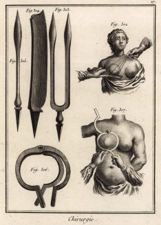 Хирургия. Инструменты для проведения операций на груди (Ивердонская энциклопедия. Том III. Швейцария, 1776 год)